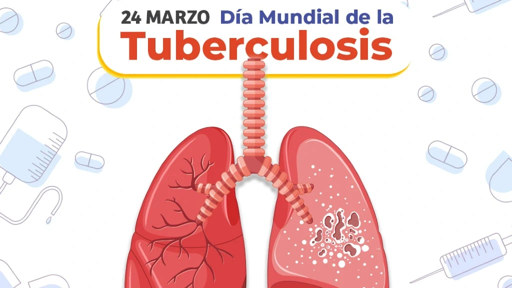 Día Mundial de la Tuberculosis 2026: ¡Sí, Podemos Poner Fin a la Epidemia! Novedades en Diagnóstico y el Llamado Urgente a la Acción