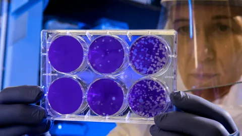 Epidemiólogo Richard Hatchett: El Riesgo de Pandemia Global Supera al de 2019 y Crece por IA y Biodiseño