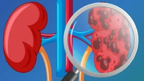 Alerta Renal: 5 Señales Silenciosas Que Tu Cuerpo No Debe Ignorar – Detección Temprana Es Clave para tu Salud