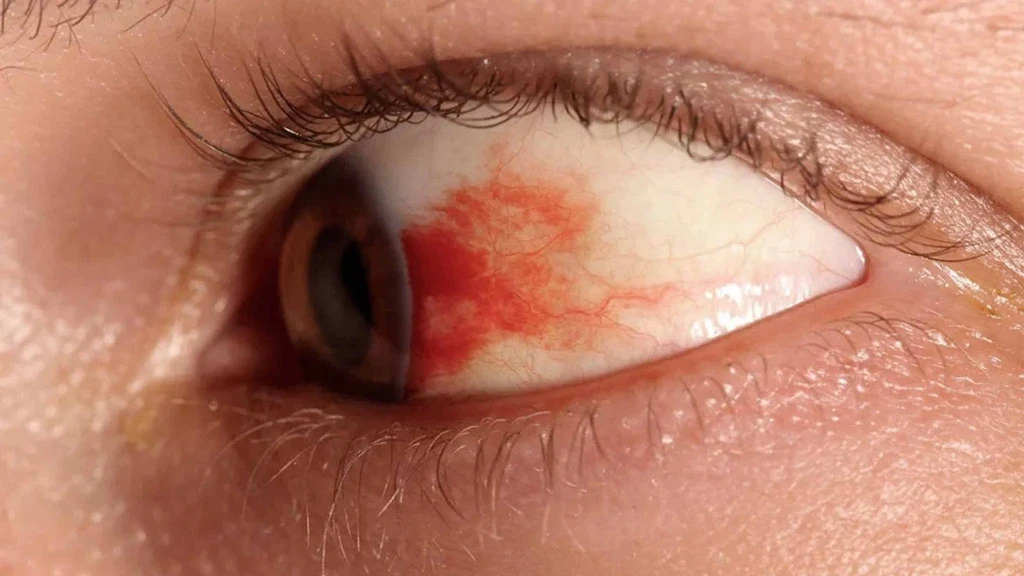 UNAM Revoluciona Tratamiento Ocular: Gotas de Vasoinhibina Contra la Ceguera por Diabetes, Alternativa a Inyecciones Dolorosas