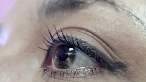 Maquillaje mal retirado, principal causa de irritación ocular crónica y síndrome de ojo seco