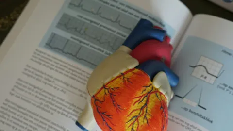 IA y Cardiología: Un Cardiólogo Mexicano Revela el Verdadero Alcance de la Predicción de Infartos y Riesgo Cardiovascular